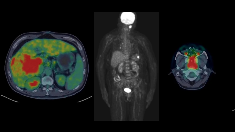 PETWB-REP: PET/CTs with full radiology reports