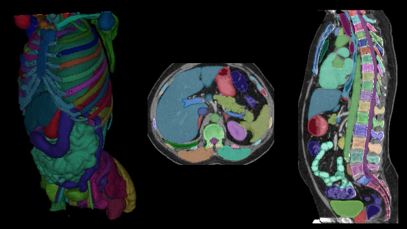 Basic Body CT Anatomy